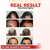 Hair Growth Spray Batana Oil Spray Natural Hair Growth Spray